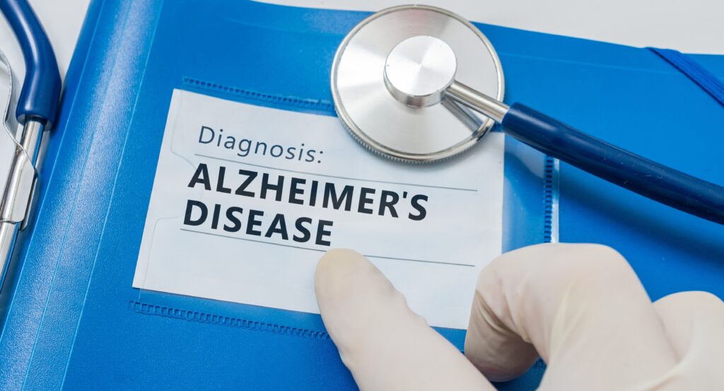 current research alzheimer's disease