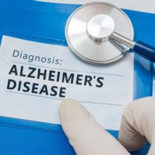 alzheimer's disease research study